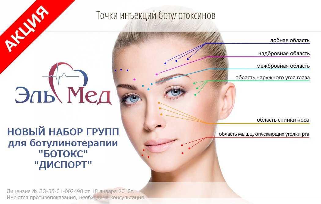 Ботулинотерапия (введение препарата ботокс)