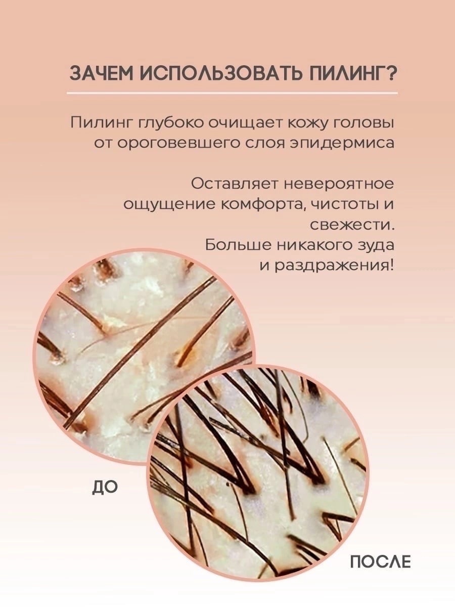 Рецепты скрабов для кожи головы в домашних условиях