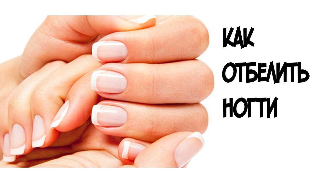 Почему темнеют ногти и как их быстро отбелить в домашних условиях?
