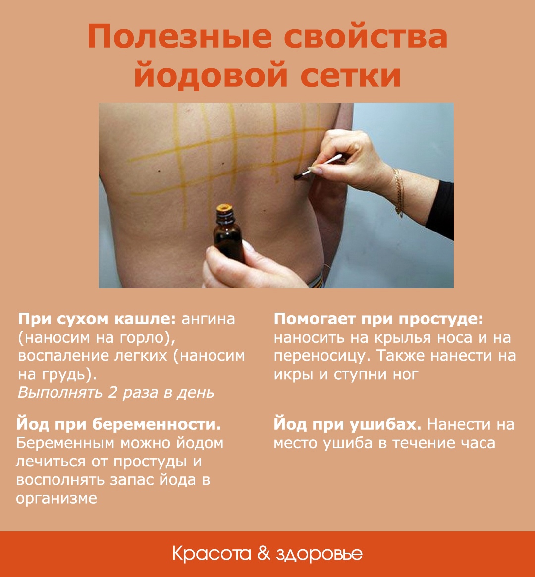 Йодовая сетка при кашле ребенку и взрослому: помогает ли, как сделать правильно
