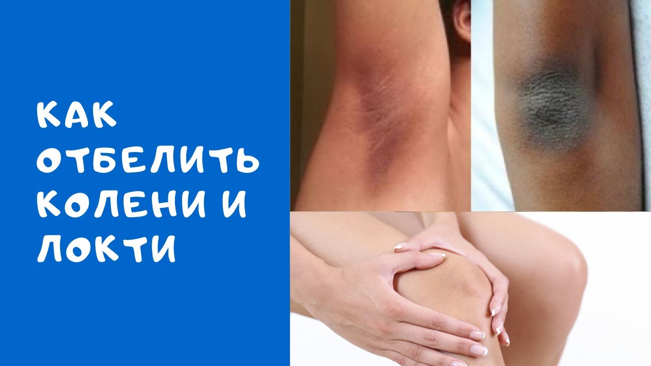 Чому на ліктях суха шкіра?