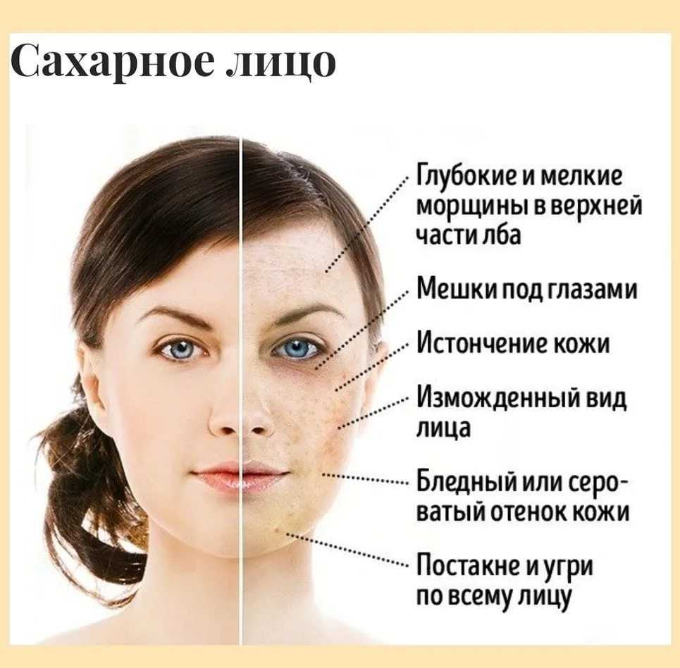 Внимание! сахар —это не еда!
