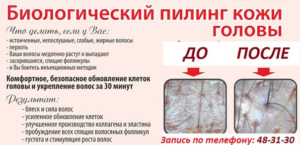 Скраб для кожи головы в домашних условиях Солевой скраб для кожи головы