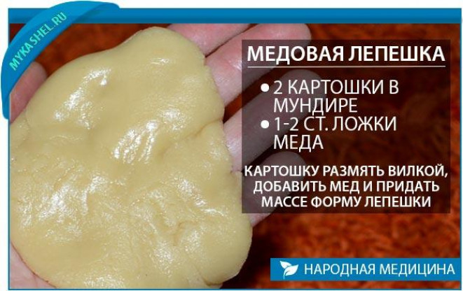 Компресс от кашля Как сделать компресс от кашля Компресс от кашля для ребенка - из картошки, меда, водки, капусты, горчицы Противопоказания Сколько держать компресс