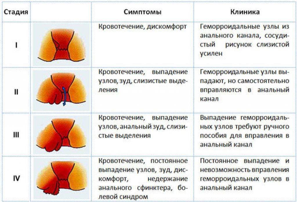 Причины геморроя у женщин, что делать при геморрое Какие народные средства и медикаменты можно применять Советы при геморрое