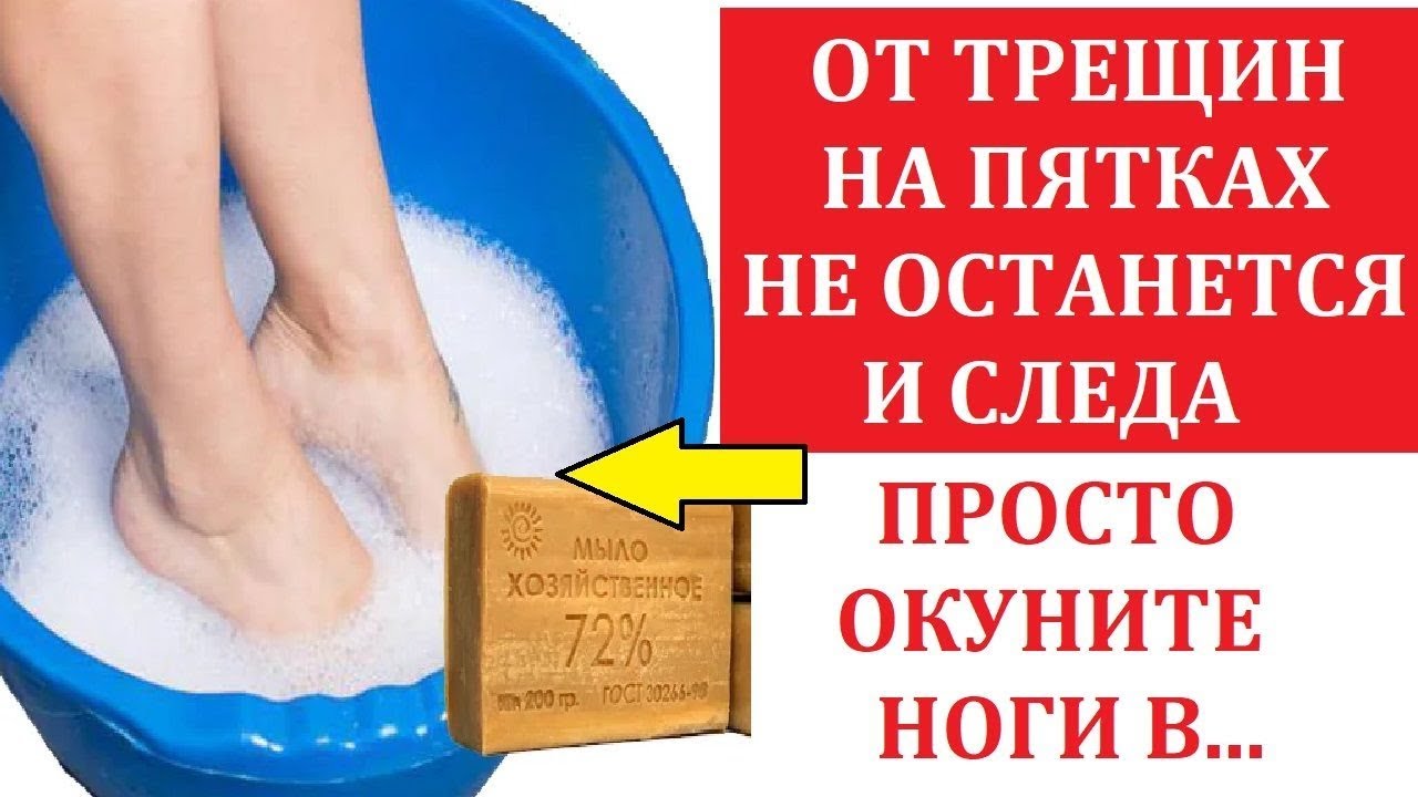 Глицерин для пяток: рецепты ванночки компрессы из глицерина для пяток