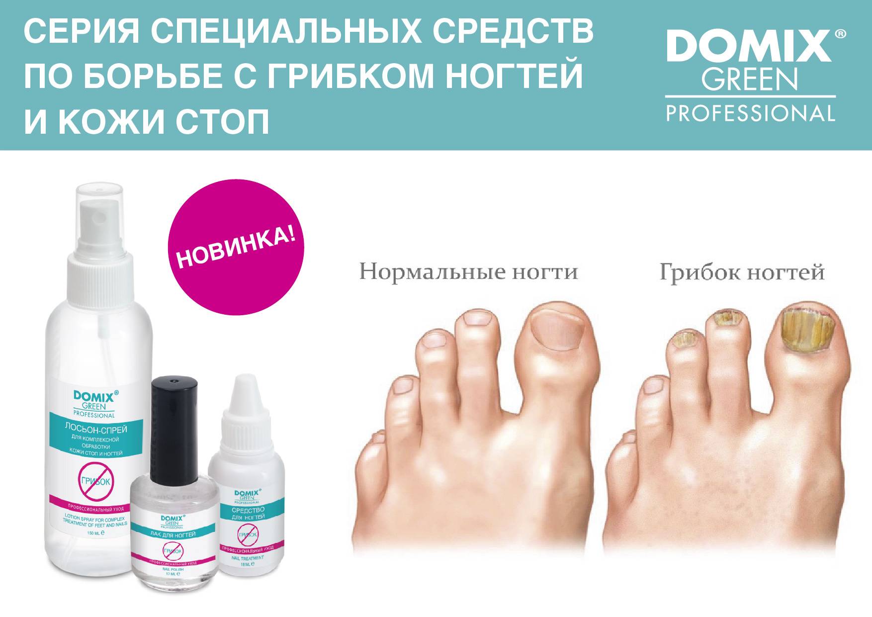 Как лечить грибок ногтей народными средствами