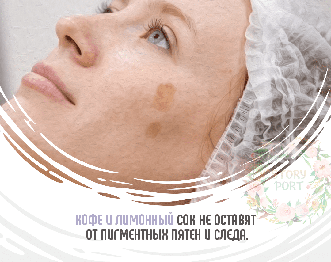 Пигментация и пигментные пятна: почему появляются, что это и как от них избавиться - косметология бьютимед