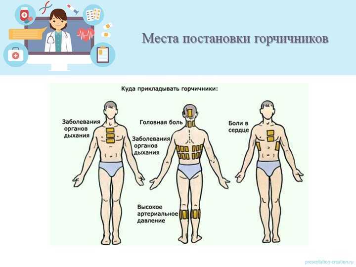Как ставить горчичники при кашле взрослому, сколько держать их | vrednuga.ru