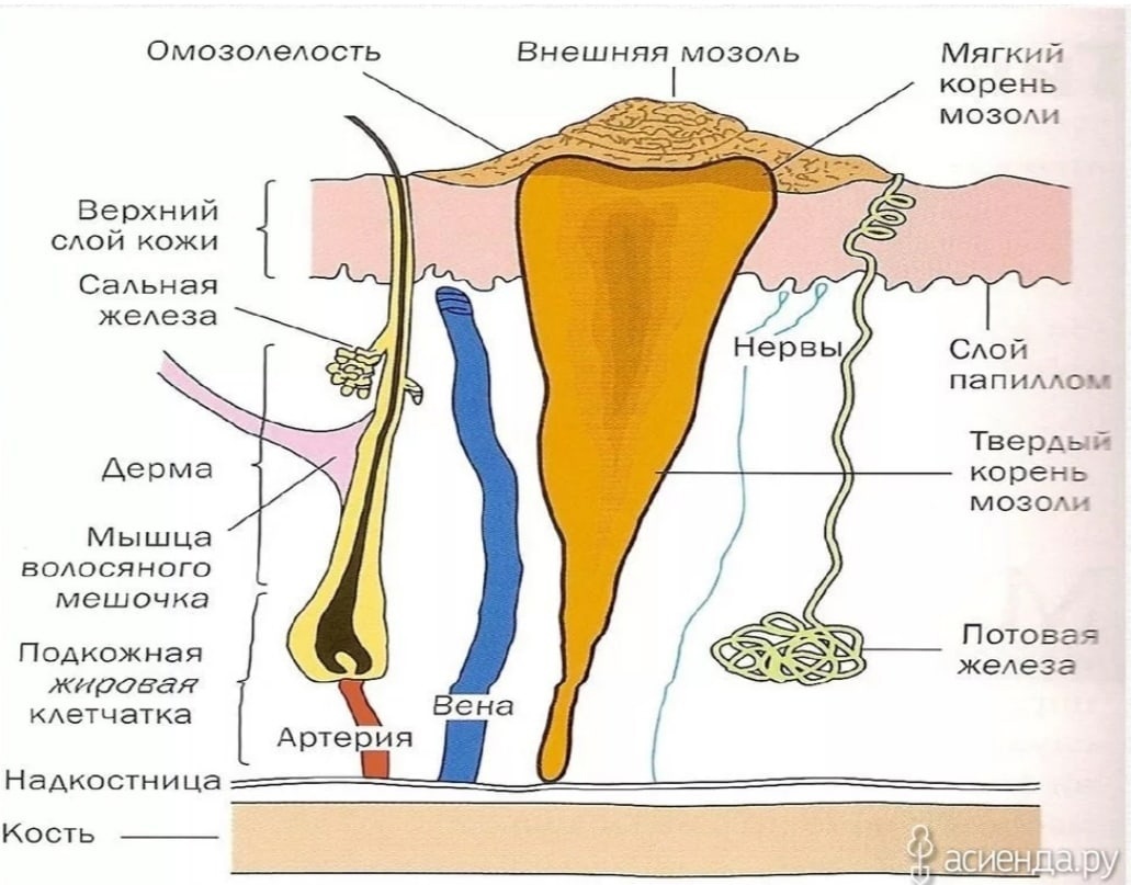Как лечить мозоли на ногах и мизинцах + первая помощь