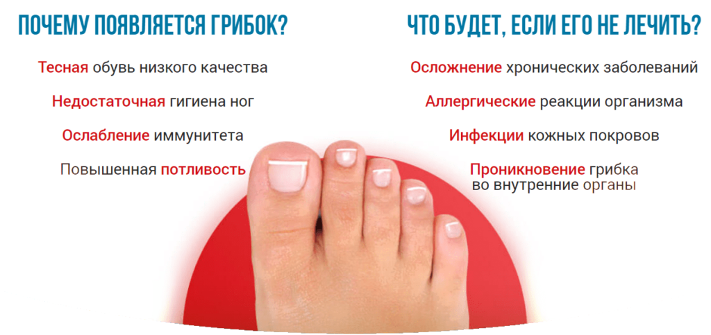 Как избавиться от грибка на ногтях ног быстро в домашних условиях
