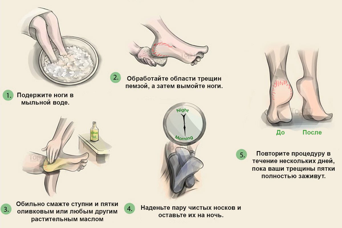 Ванночки для ног — 17 рецептов на любой случай