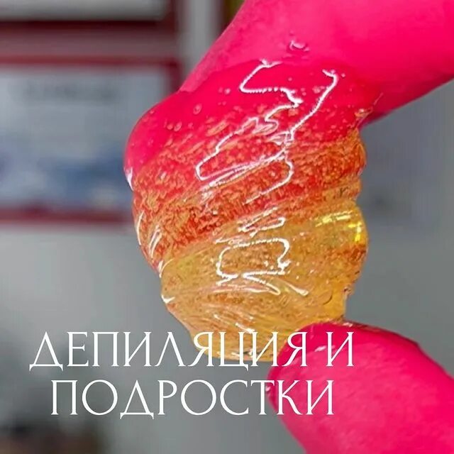 Какая эпиляция самая эффективная: отзывы