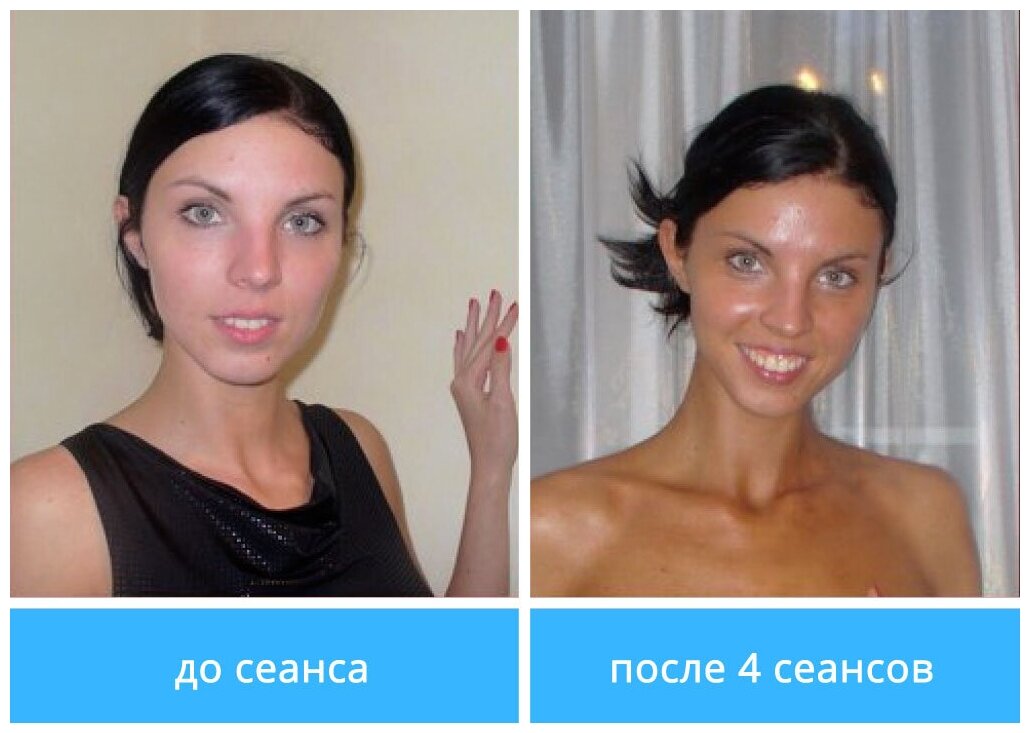Как отбелить лицо от загара в домашних условиях