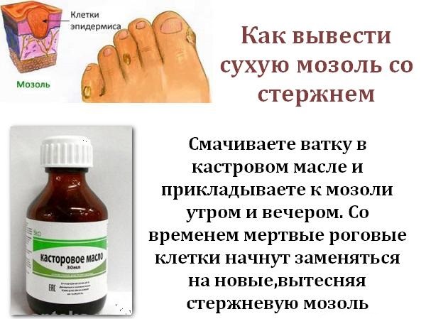 Сухая мозоль: причины появления и методы удаления