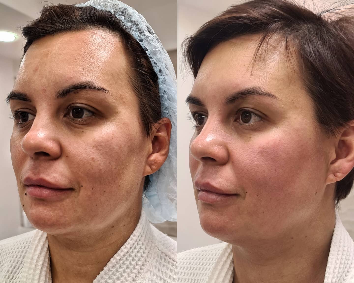 Ritamix's blog : darphin l’institut youth resurfacing peel with a botanical blend. отзыв.
