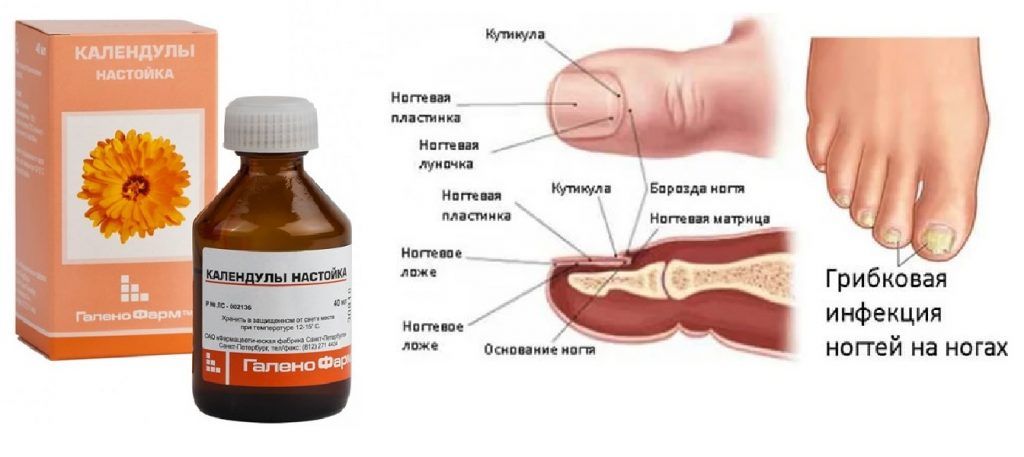 Как перекисью водорода лечить грибок ногтей на ногах