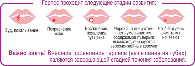 Губной герпес - лечеие * клиника диана в санкт-петербурге