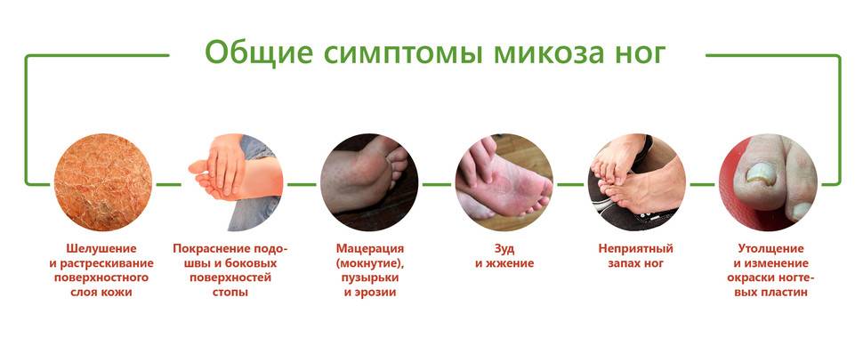 Йод от грибка ногтей - способы применения, эффективность и побочные действия