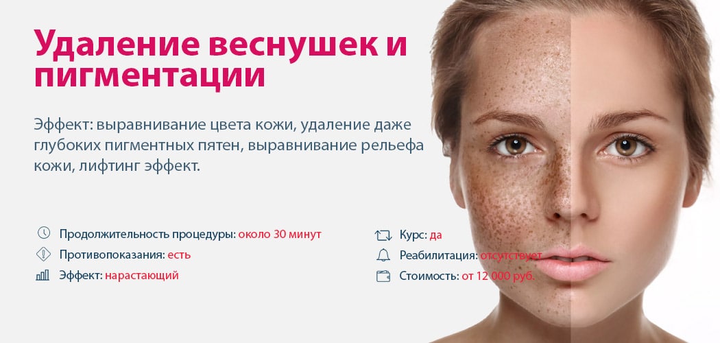 Эффективные методы борьбы с пигментацией ✔️ блог клиники лица