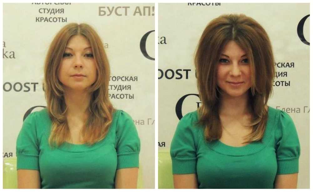 Буффант и буст ап: в чем отличие процедур?