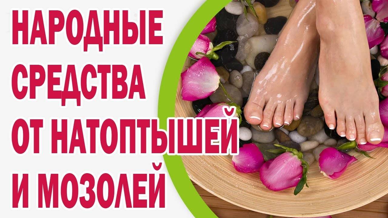 Натоптыши на пятках - как убрать в домашних условиях самостоятельно, крема и мази, народные рецепты | maritera.ru