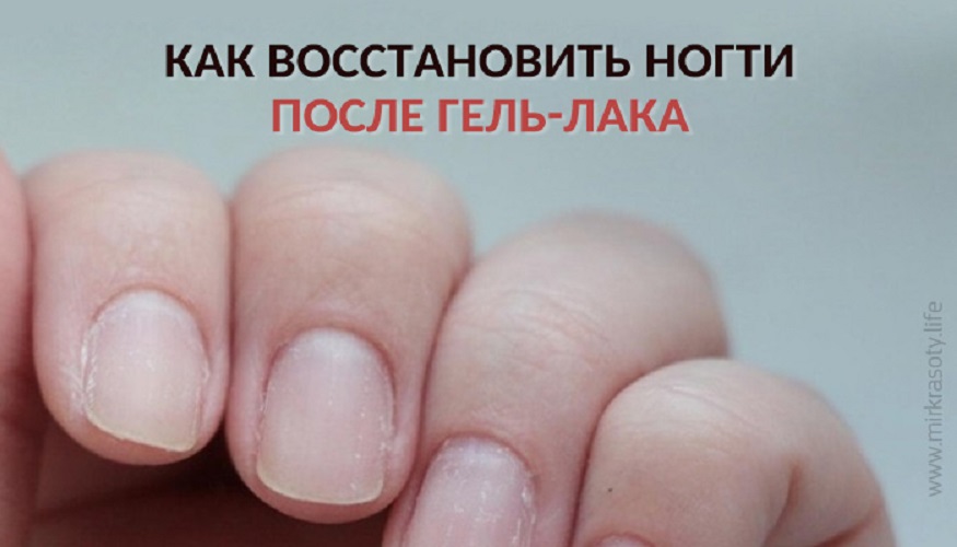 Как восстановить ногти после шеллака и гель-лака: лечение, укрепление, профилактика в домашних условиях