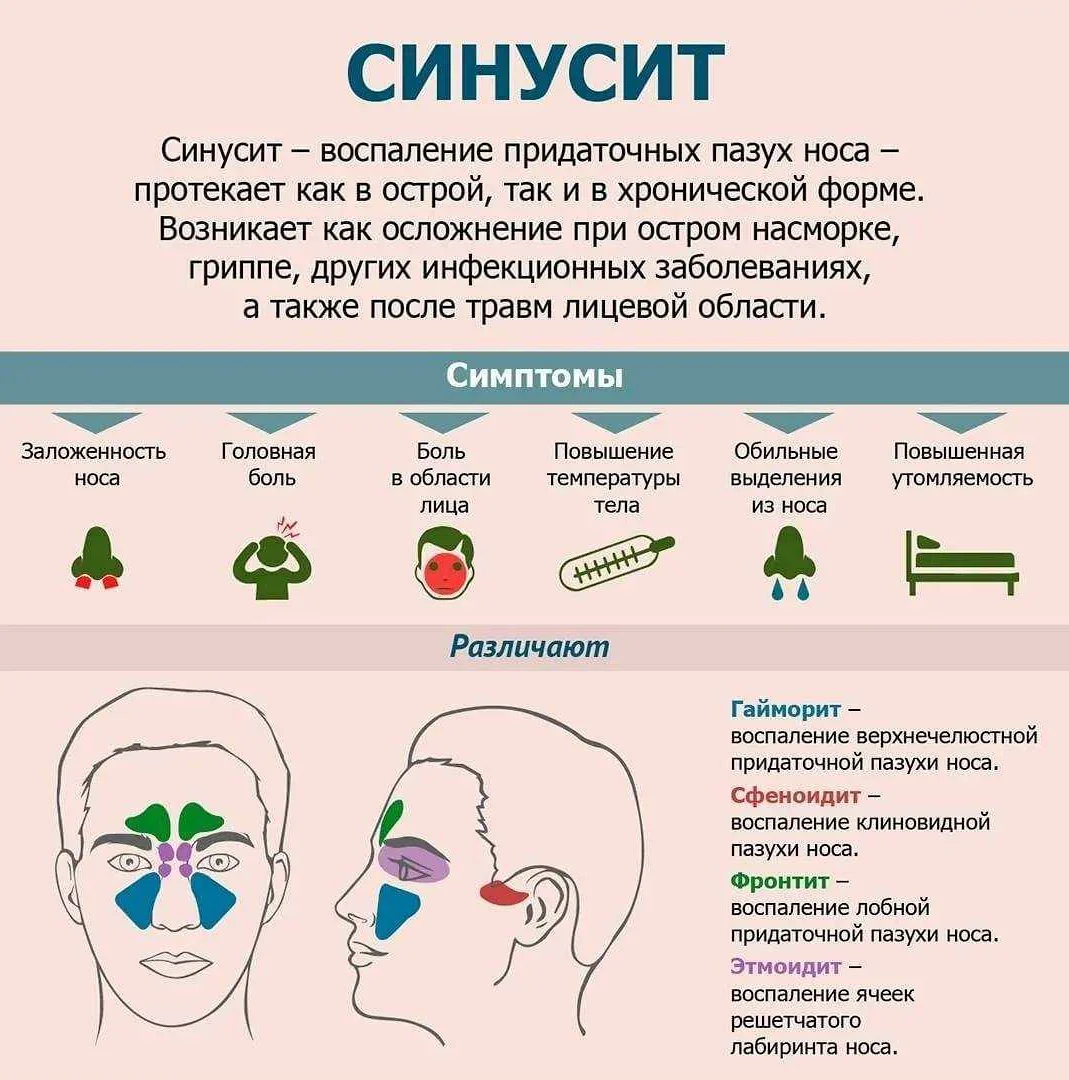 Все народные средства от насморка и заложенности носа