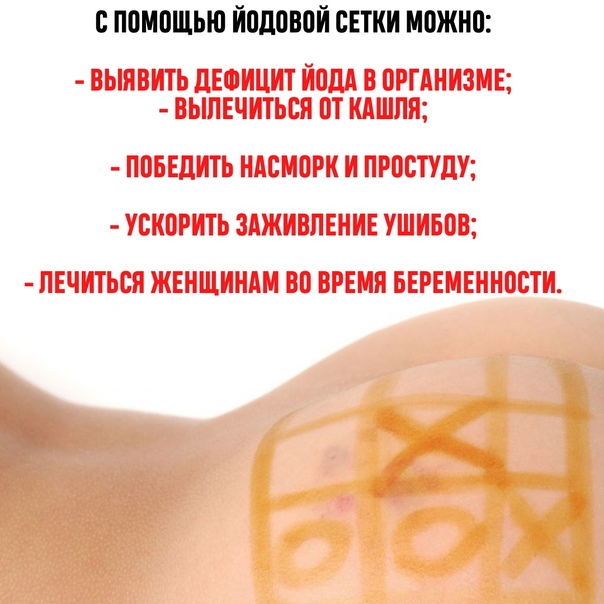Можно ли делать йодовую сетку при трахеите
