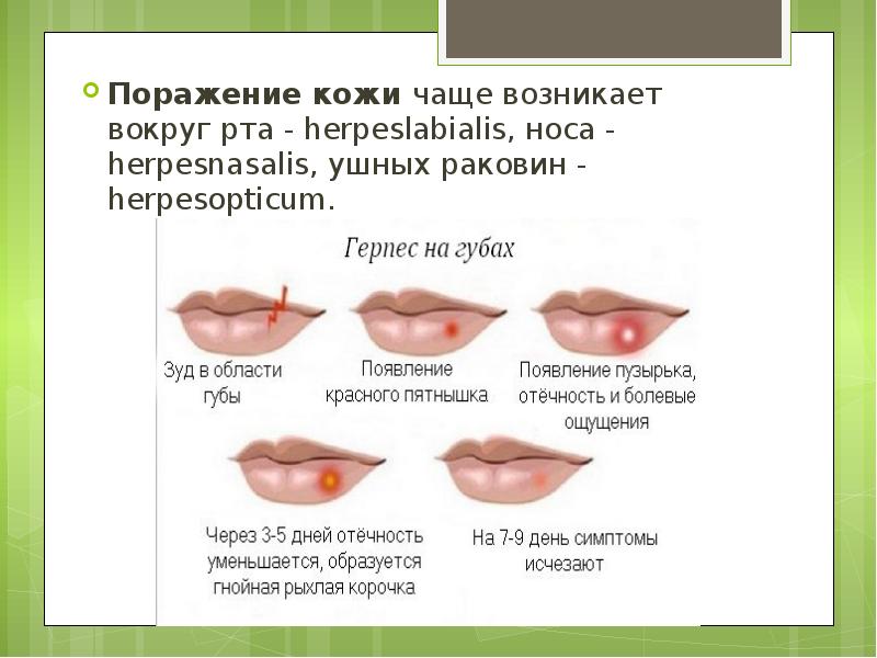 Почему долго не проходит герпес на губах и что делать при затяжной простуде