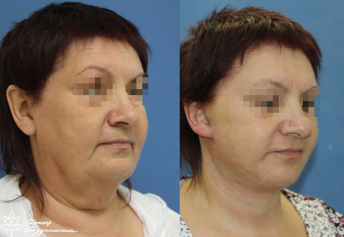 Косметика французского бренда biologique recherche: отзывы
