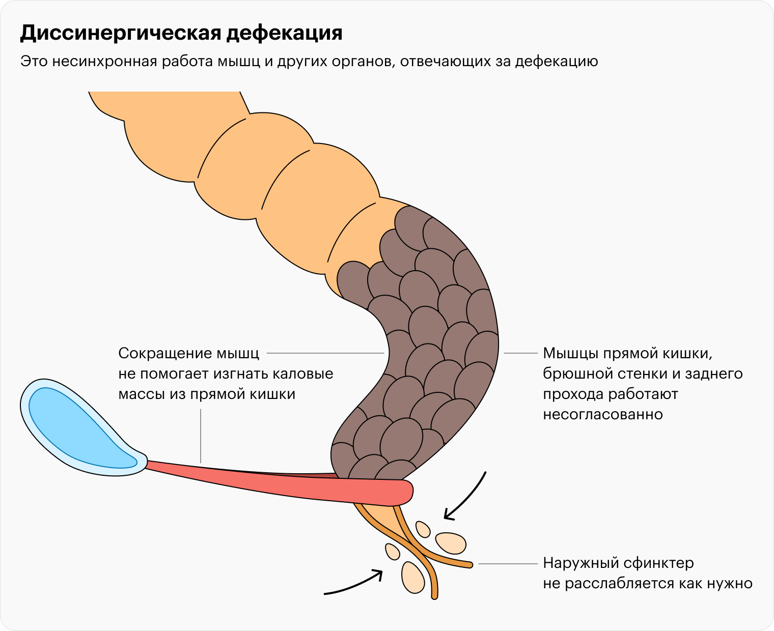 17 лучших продуктов от запора