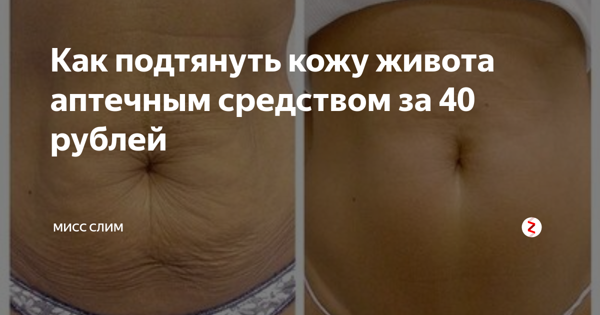 Кожа после похудения: как подтянуть и как избежать обвисания