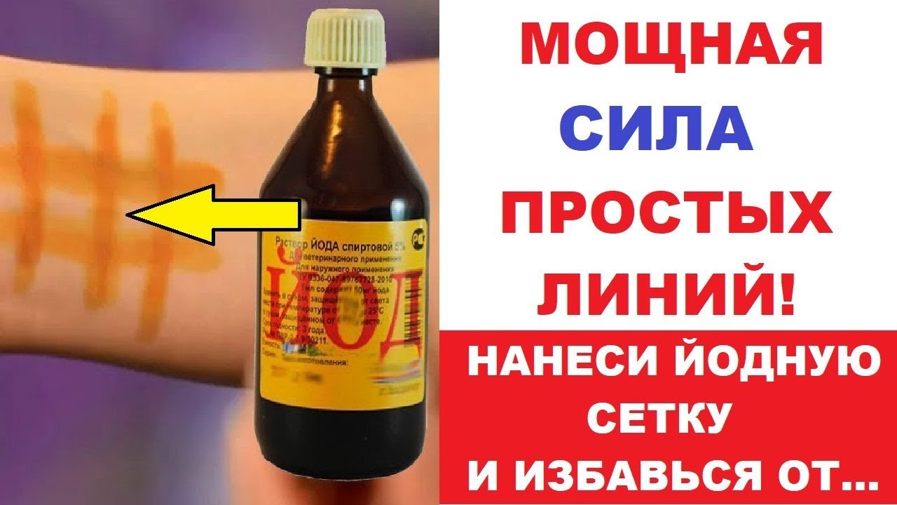 Как сетка из йода помогает от кашля