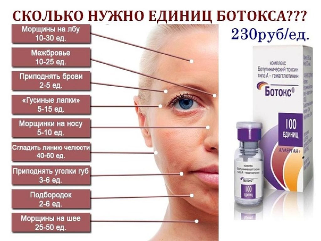 Наш редактор испробовал уколы ботокса на себе Как проходит процедура и основные правила после уколов ботокса