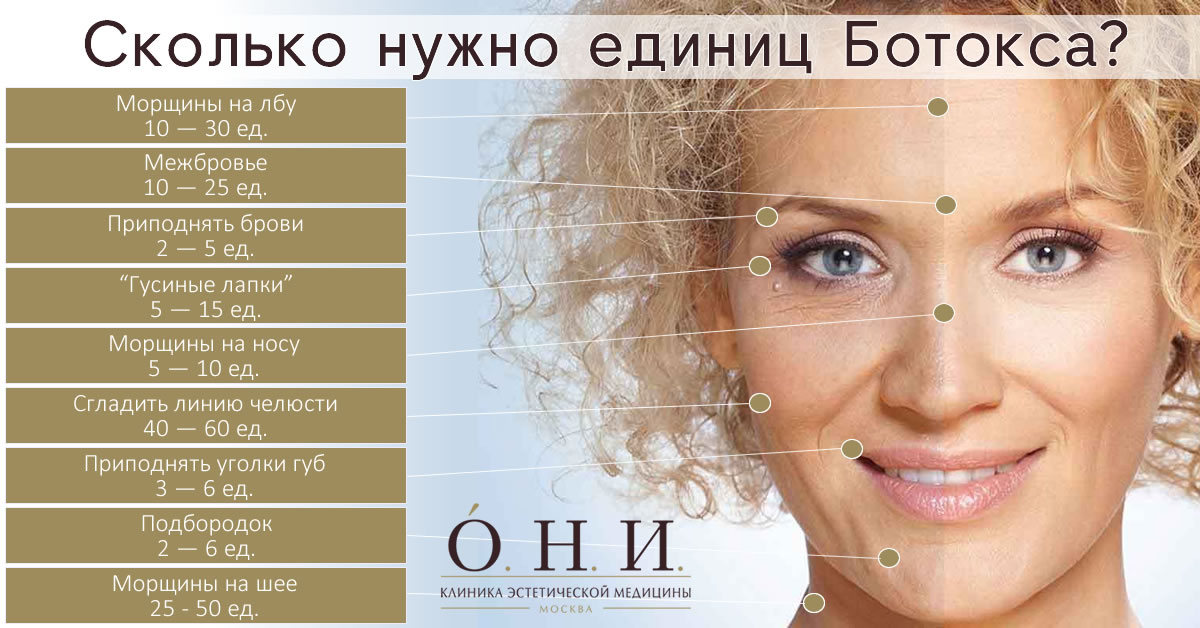 Филлеры или ботокс