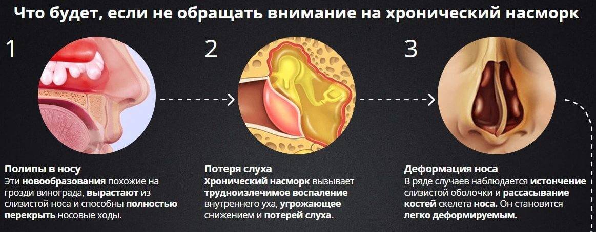 Гайморит: симптомы, причины, диагностика и лечение | блог лдц здоровье