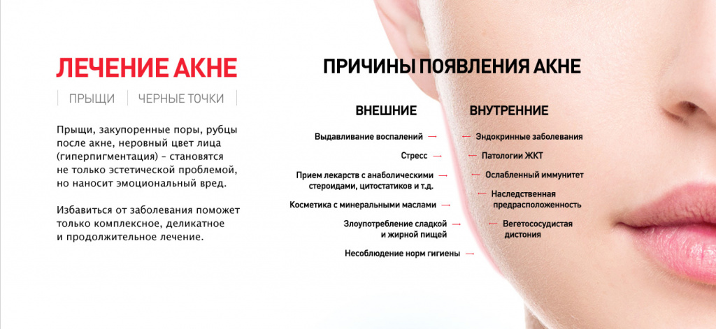 Как уменьшить припухлость и покраснение прыщей