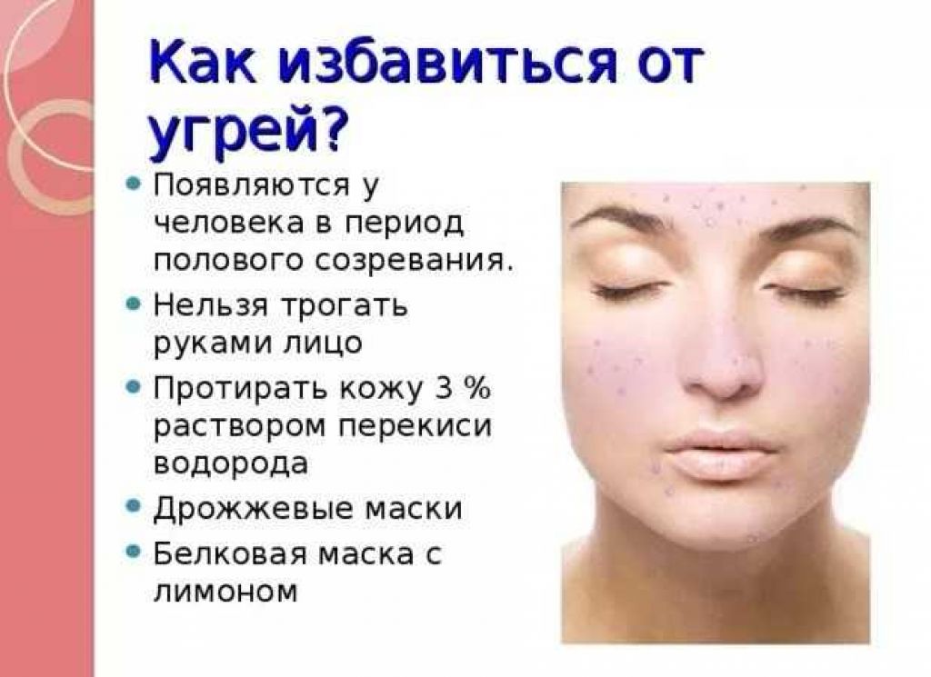 16 мазей от прыщей на лице: недорогая и эффективная для подростков от угрей, какое средство самое эффективное, витамины, умывалка от юнешеской угревой сыпи, чем протирать лицо, как избавиться от акне
