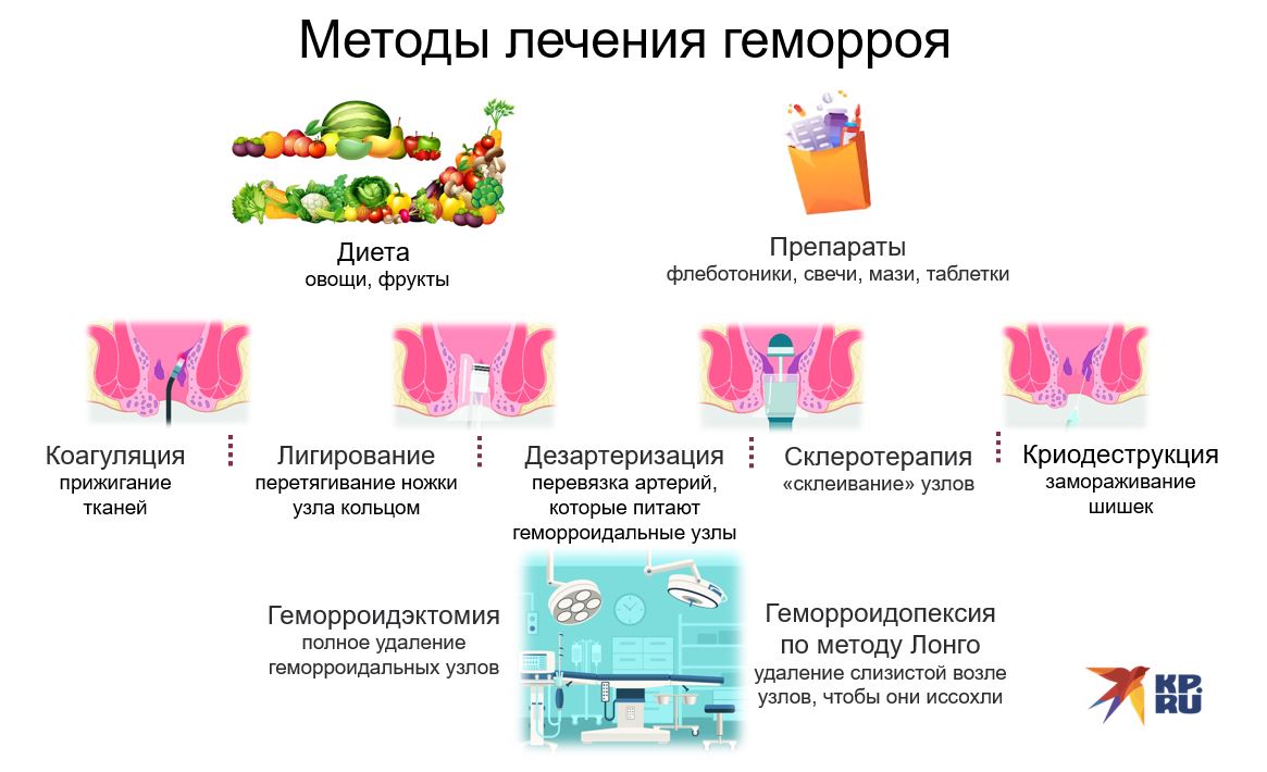 Какие преимущества лечения геморроя травами Какими средствами можно лечить геморрой Травы при геморрое - как их использовать