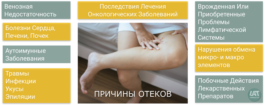 Лечение ног у пожилых людей: отёки, судороги, ноги отказывают