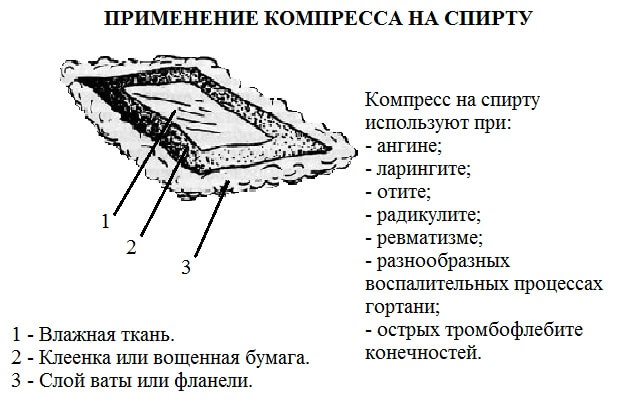 Как правильно сделать компресс из водки или спирта