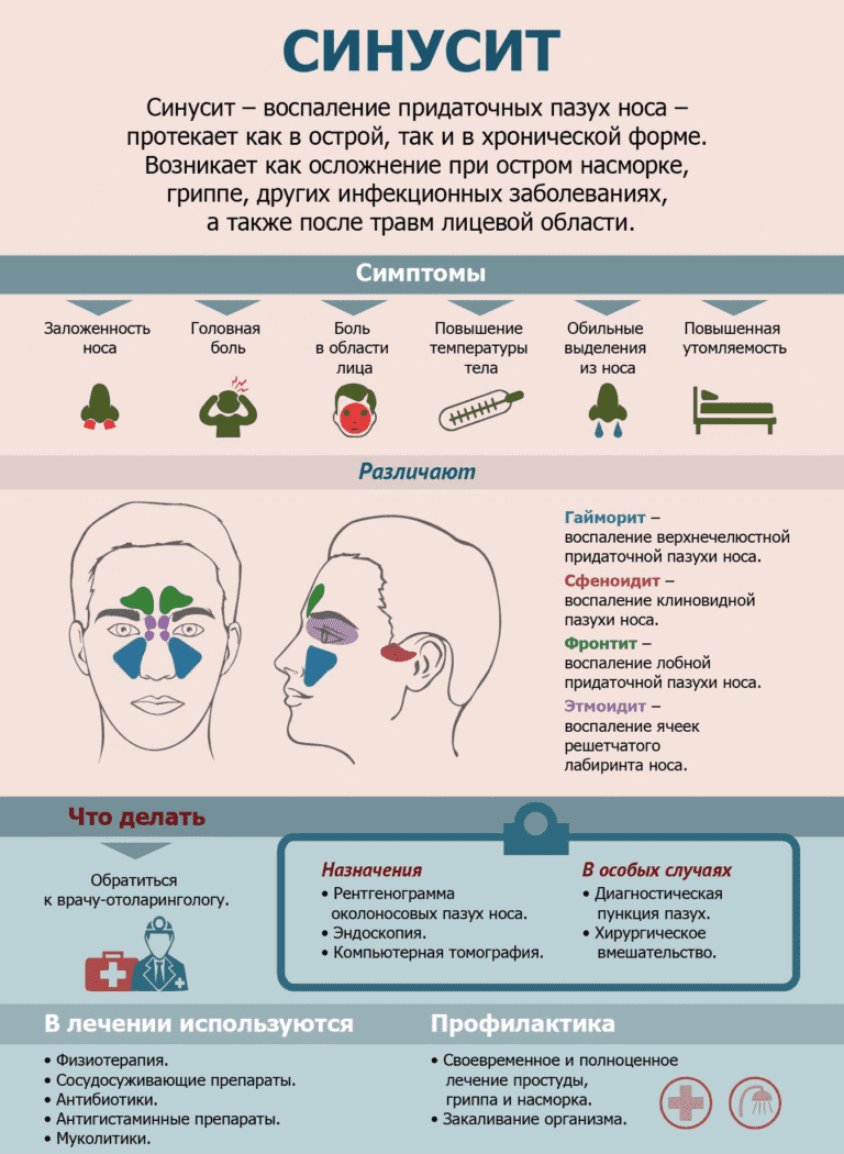 Как  вылечить насморк и облегчить заложенность носа, что делать при насморке у взрослого.