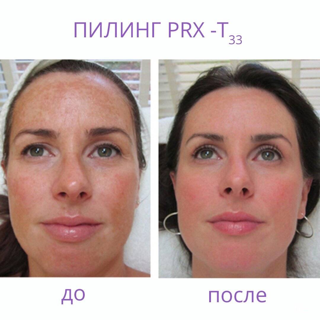 Азулен: его роль и применение в косметике для кожи лица