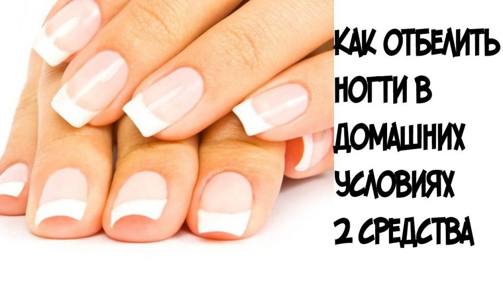 Чем отбелить кутикулу возле ногтя. как отбелить ногти в домашних условиях – зубная паста, лимон, сода